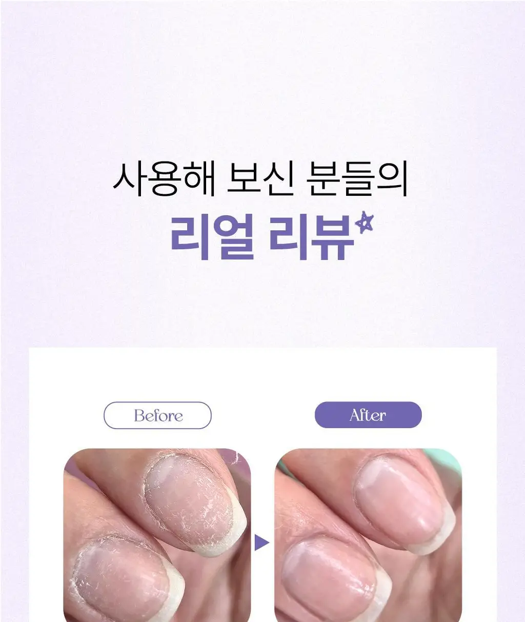 [대용량] 위드샨 네일&큐티클 오일펜 올케어 세트 (4ml x 4ea) 상세페이지 18